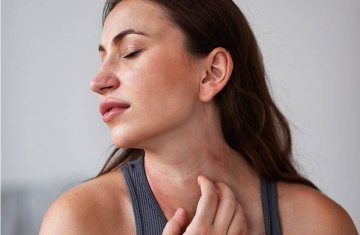 Атопический дерматит