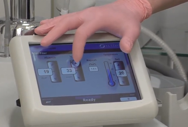  Удаление пигментных пятен