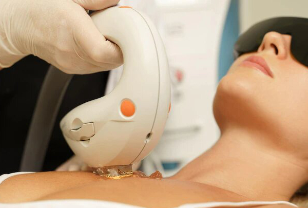 Удаление сосудов лазером