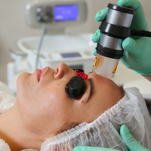 Лечение акне