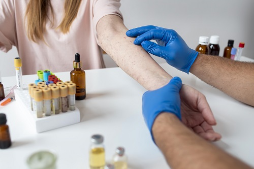 Лечение мелазмы в москве